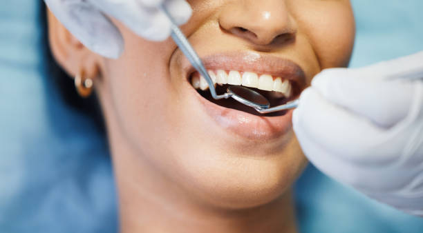 Best Emergency Dentist for Knocked-Out Tooth in Tequesta, FL